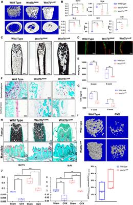 Wnt7b Inhibits Osteoclastogenesis via AKT Activation and Glucose Metabolic Rewiring